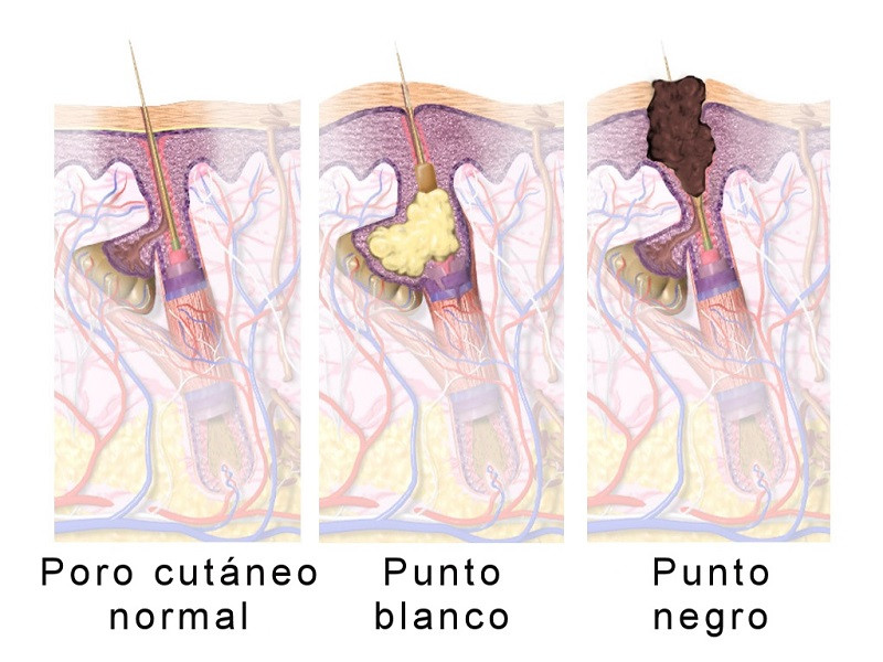 Punto negro
